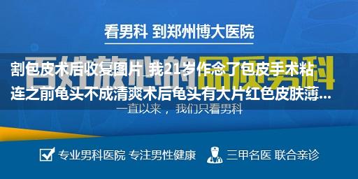 割包皮术后收复图片_我21岁作念了包皮手术粘连之前龟头不成清爽术后龟头有大片红色皮肤薄...